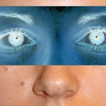 image otoplpost-vi-jpg