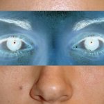 image otoplpre-vi-jpg